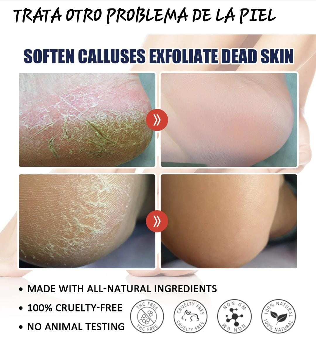 😍Balsamo Hidratante para pies agrietados|foot balm😍