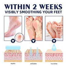 😍Balsamo Hidratante para pies agrietados|foot balm😍