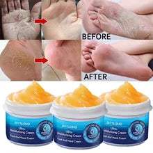 😍Balsamo Hidratante para pies agrietados|foot balm😍