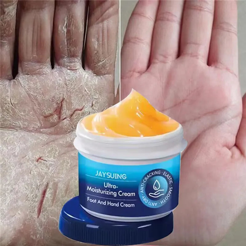 😍Balsamo Hidratante para pies agrietados|foot balm😍