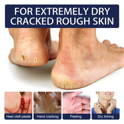 😍Balsamo Hidratante para pies agrietados|foot balm😍